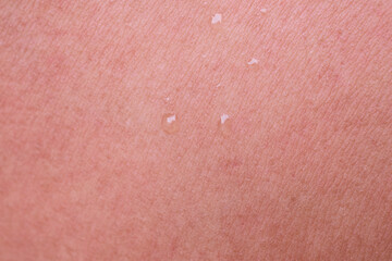 Fototapeta premium human skin texture background texture with water drop abstract close-up