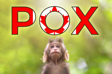 A new outbreak of viral infection in Canada, monkey pox. Little monkey look at text POX with...