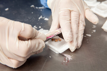 Scientist preparing paraffin blocks containing biopsy tissue for sectioning. Pathology laboratory....