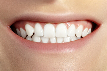 Dental Beauty. Beautiful Macro with perfect White Teeth. Natural Make-up. Whitening Tooth, Wellness Treatment