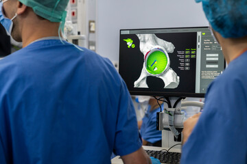 Naklejka premium Team of doctor perform total hip arthroplasty replacement surgery in osteoarthritis patient inside the operating room. mako robot-assisted - robotic hip and knee replacement surgery 