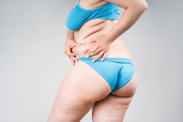 Overweight woman with fat hips, buttocks and flabby belly, obesity female body