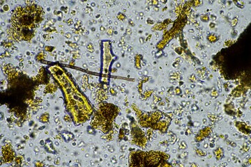 soil fungi under the microscope, soil microbes organisms in a soil and compost sample, fungus and...