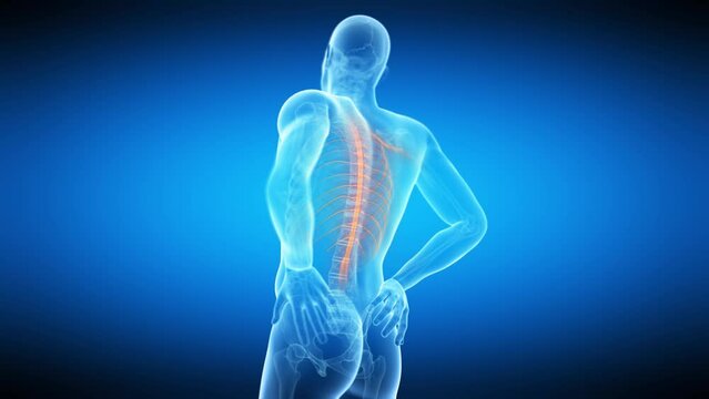 3d rendered medical animation of  a man having a painful back