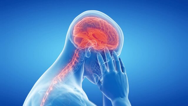 3d rendered medical animation of  a man having a headache
