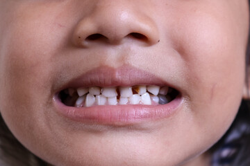 close up of a little girl with a smile showing his teeth