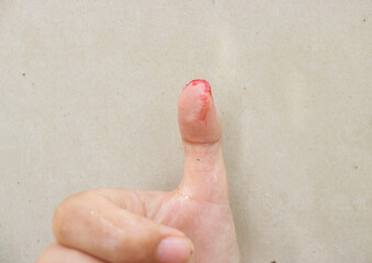 Fingers and thumbs are injured and bleeding, cuts on fingers isolated on gray background