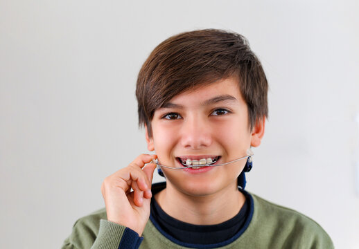 Children Tooth Care And Hygiene. Portrait Of A Teenager Boy With Diastema Overbite Teeth Missing Gap Wearing Orthodontic Appliance Treatment. Dental Braces With Child Concept.