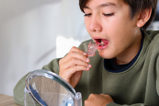 Teenager boy with diastema overbite teeth missing gap problem wearing orthodontic appliance treatment infant of the mirror. Dental braces and child tooth care concept.