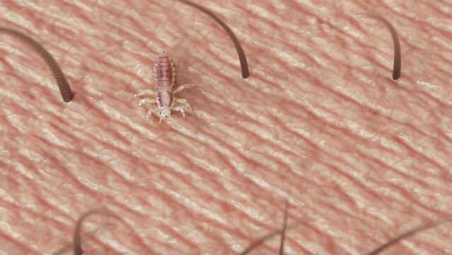 3d rendered animation of  a closeup shot of a louse