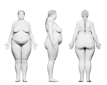 3d rendered medical illustration of an obese female body
