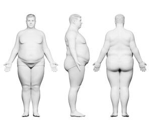 3d rendered medical illustration of an obese male body