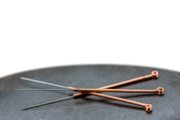 Naturmedizin und sanfte Medizin mit Akupunktur