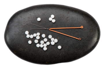 Naturmedizin und sanfte Medizin mit Akupunktur