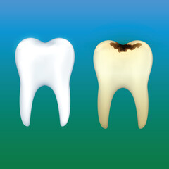 teeth dental care