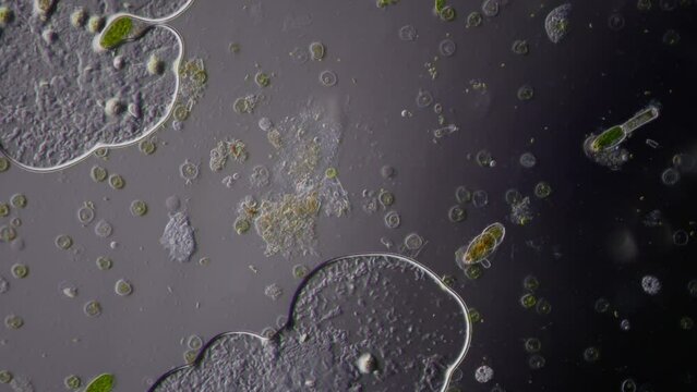 Amoeba and many other microorganisms in the frame. Also in the frame are colonies of unicellular algae and bacteria. Combination of oblique illumination microscopy and darkfield microscopy methods