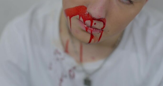 Consequences of bullying in the team, the broken face of the guy. Bloodied nose. He blinks his eyes, fear. Shock state.