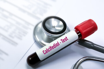 Blood sample for 25-hydroxycholecalciferol test, also known as 5-hydroxyvitamin D₃, calcifediol or calcidiol, is a form of vitamin D produced in the liver by hydroxylation of vitamin D₃