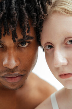 black young guy and albino girl