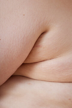 Skin Details