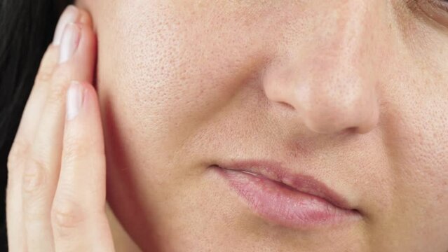 Close-up of a female face with enlarged pores, the concept of beauty, problem skin. Dermatitis, seborrhea. Skin treatment.