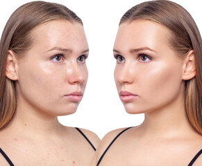 Face of beautiful woman before and after skin retouch.