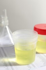 Containers with urine samples for analysis and glassware on test forms in laboratory