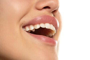 Smiling woman mouth with great healthy white teeth