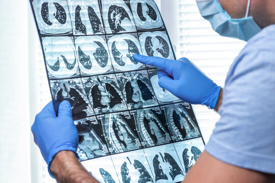Man doctor in mask examines MRI in hospital
