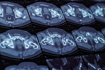 Close up of a body CT scan background