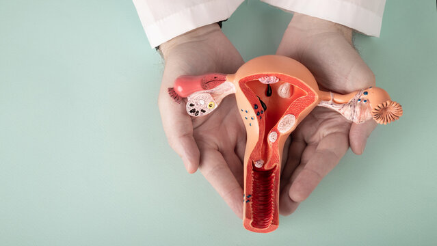 Doctor Gynecologist Holds Model Of Female Reproductive System In The Hands. Help And Care Concept