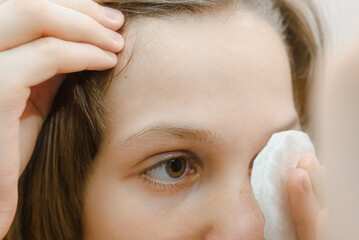 closeup of teenager boy doing cosmetic procedures using cotton pad