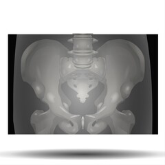 X-Ray of Pelvis - Fla source file available - Structure of the pelvis. Anatomical poster of human skeleton. Pelvic bones concept. Sacrum, Ischium, pubis and ilium. Coccyx and pubic symphysis in male. - obrazy, fototapety, plakaty