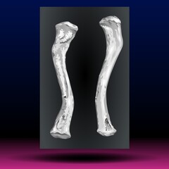 X-ray of Shoulder Bone - Fla source file available - x-ray images of the shoulder joint modified coracoclavicular stabilizer to see injuries bones and tendons for a medical diagnosis. Medical image.