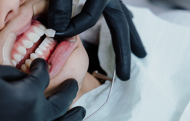Las manos de dentista con lentes de contato en consultorio odontologico