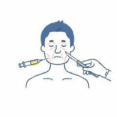 美容整形手術をする男性