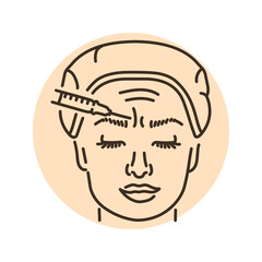 Botulinum wrinkle therapy between the eyebrows color line illustration. Hyaluronic injection.