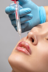 Injections for lips augmentation anti wrinkle injections on the face of a beautiful woman. Female...