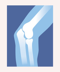 Xray scan concept. Medical anatomical poster with elbow, shoulder and forearm bones. Design element for infographics. Human skeleton. Cartoon modern flat vector illustration on white background