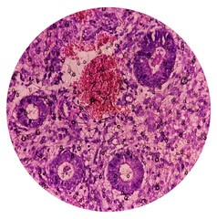 Endometrial tissue: Photomicrograph of endometrial tissue, proliferative phase in endometrium. Follicular phase.