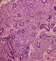 Endometrial tissue: Photomicrograph of endometrial tissue, proliferative phase in endometrium. Follicular phase.