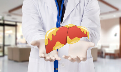 doctor touch fatty on liver , concept fatty liver - obrazy, fototapety, plakaty