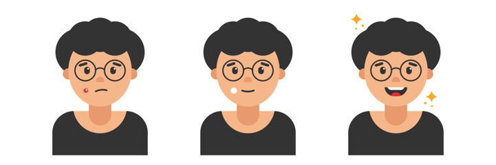 Young man, teenage boy getting rid of pimples, acne, using healing patch, cream for skin. Skin care routine. Before and after results.
