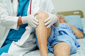 Doctor checking Asian elderly woman patient with scar knee replacement surgery in hospital.