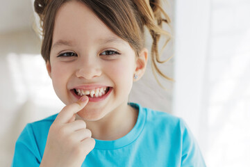 The child has lost a tooth. Little girl without a tooth. The first tooth fell out. High quality photo - 539173212