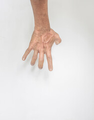 Concept image showing symptoms of hand muscles and fingers of an elderly person with wrinkled skin....
