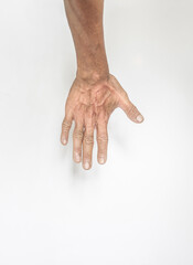 Concept image showing symptoms of hand muscles and fingers of an elderly person with wrinkled skin. rough on a white background