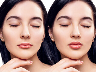Female lips before anf after augmentation procedure.