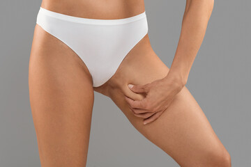 Liposuction Concept. Slim Woman In White Panties Touching Inner Thigh Skin