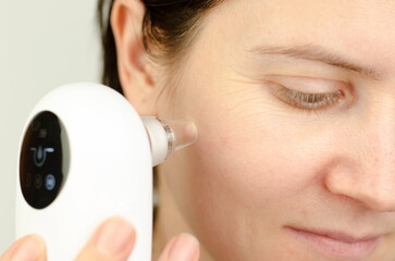 Close-up of using a facial blackhead removal machine. Cosmetic procedure at home, woman cleaning face with vacuum blackhead remover.